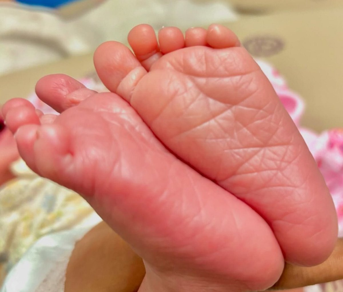 dinamani2F2024 08 252Fkcyl7j0q2Fbaby