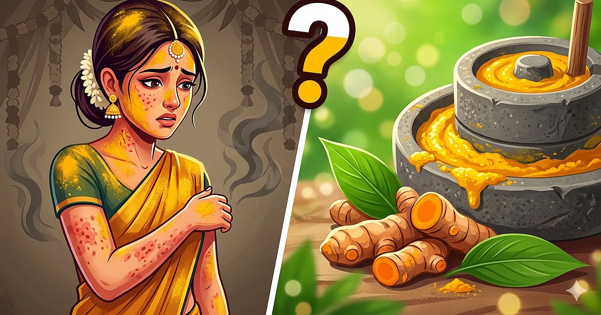 Doctor Vikatan: மணப்பெண்ணின் உயிரைப் பறித்த மஞ்சள்; மரணத்துக்குக் காரணமாகும் அளவுக்கு ஆபத்தானதா?